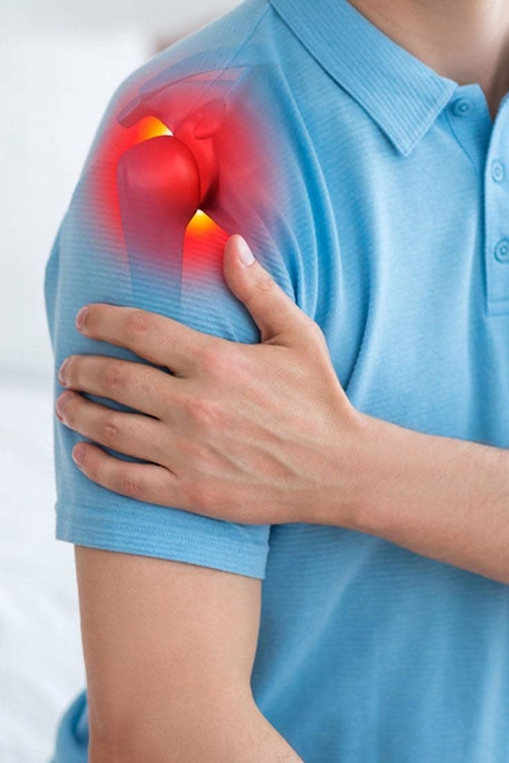 Frozen shoulder
