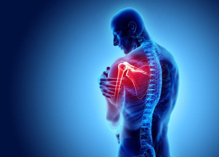 Thoracic outlet syndrome