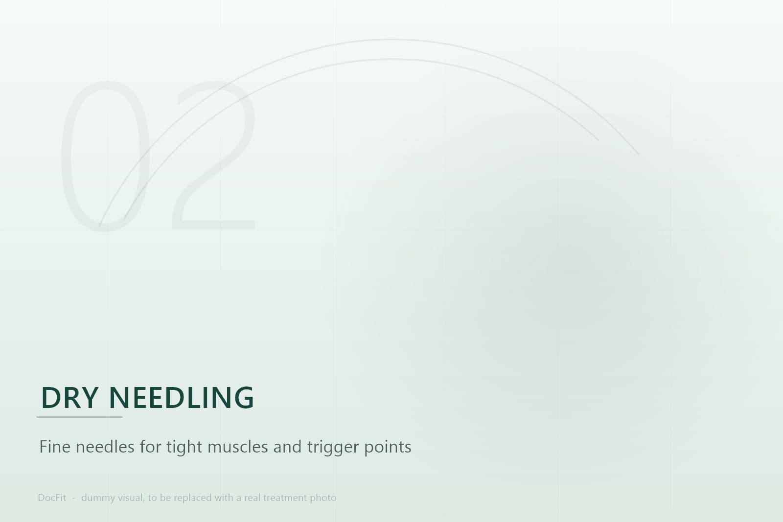 Dry needling